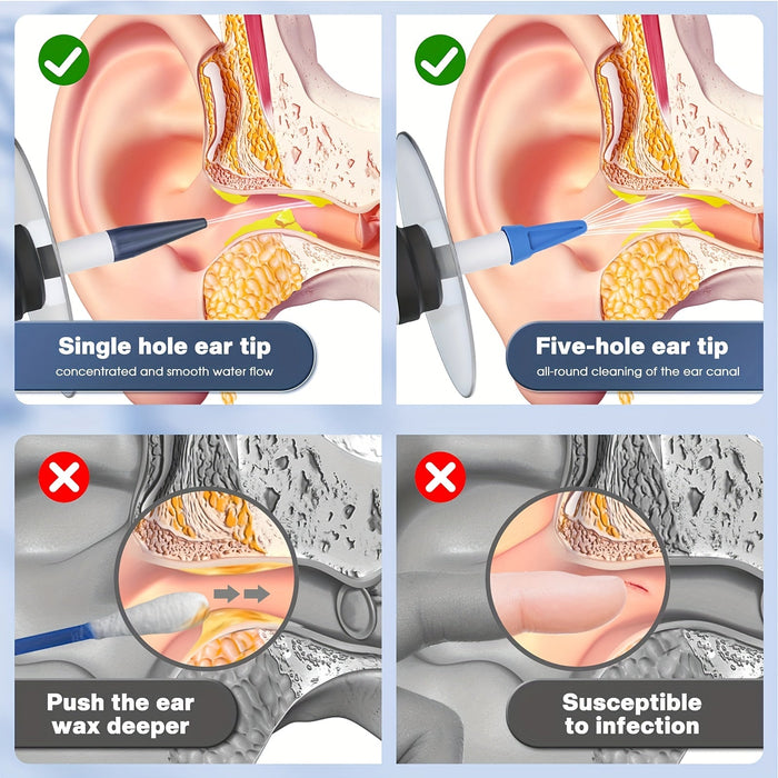 Elektrische Oorreinigingsset – Veilig Irrigatiesysteem met Wegwerp Mondstukken