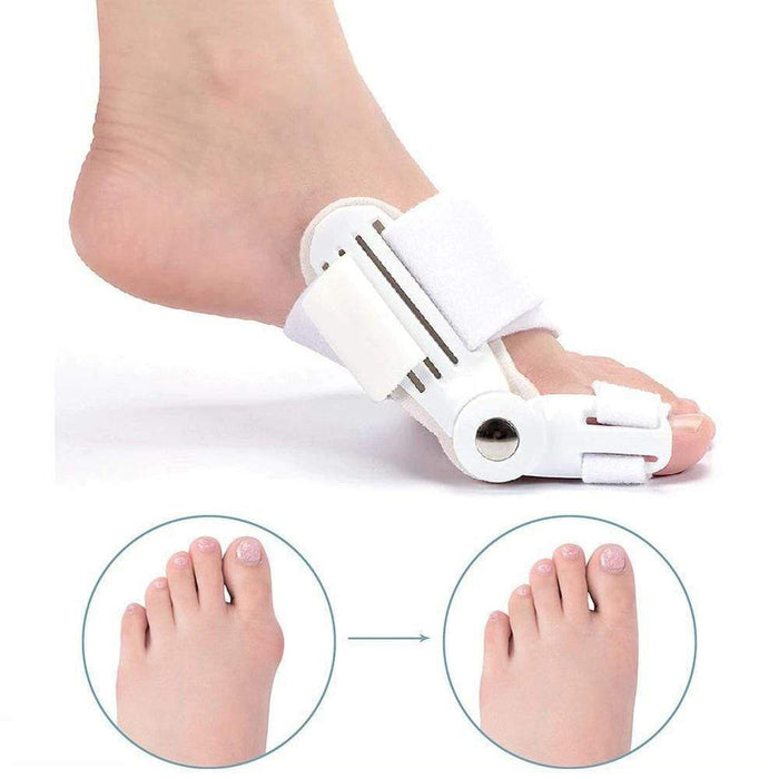 OrthoCorrect Teenspalk – Corrigerende Hallux Valgus Oplossing