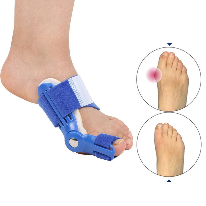 OrthoCorrect Teenspalk – Corrigerende Hallux Valgus Oplossing