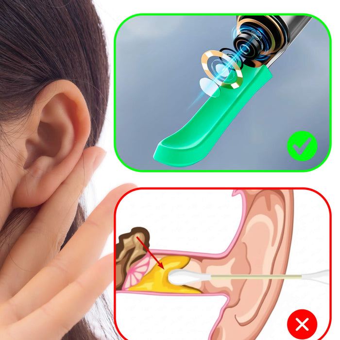 ClearView Oorreiniger – Slim, Veilig en Hygiënisch